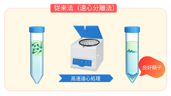 一般的な遠心分離による精子調整法