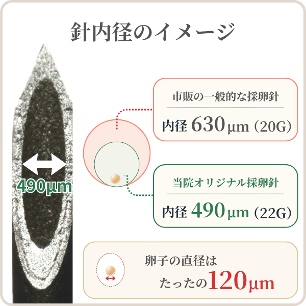 新橋夢クリニックの22G極細採卵針と一般的な20G採卵針の内径比較