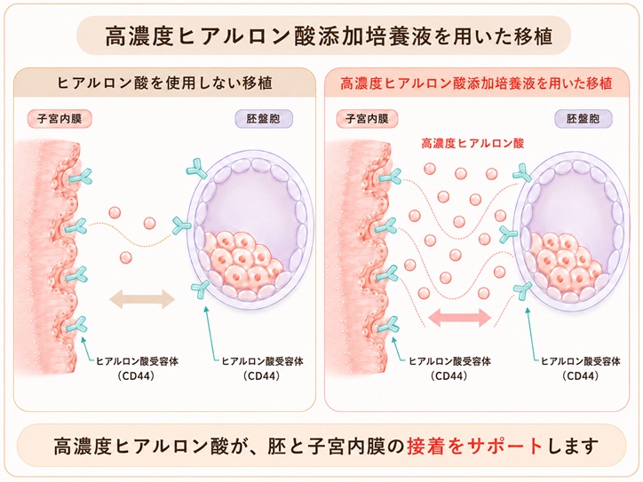 高濃度ヒアルロン酸添加培養液を用いた胚移植