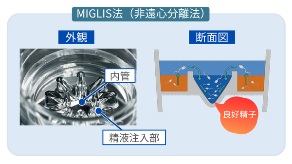 MIGLISによる遠心操作を行わない精子調整法