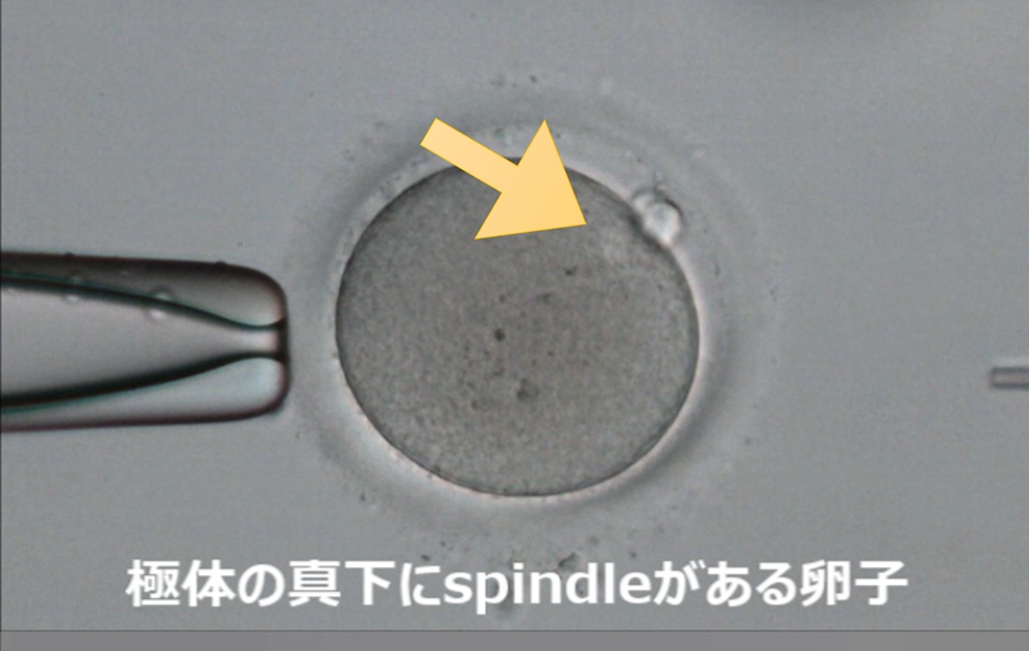 紡錘体が極体の真下にある卵子
